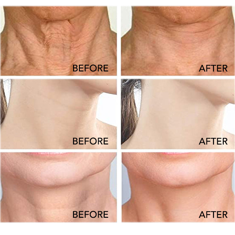 Kewalins LERFM Hexapeptide Niacinamide Firming and Lifting Roller Neck Cream Anti Ageing Fade neck lines 120g